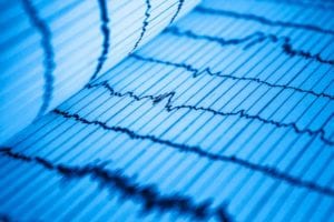 ¿INFARTO AGUDO DE MIOCARDIO, SCASEST, SCACEST, IAMCEST, ANGINA INESTABLE ?: Un galimatías difícil de comprender.