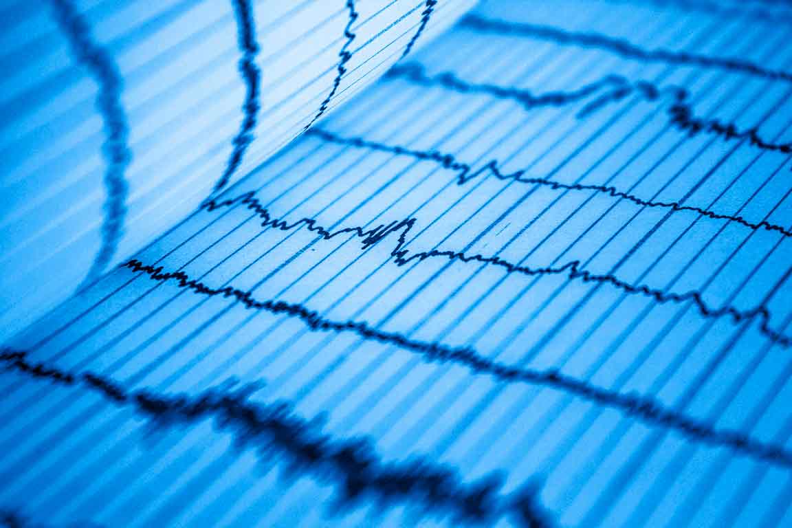 ¿INFARTO AGUDO DE MIOCARDIO, SCASEST, SCACEST, IAMCEST, ANGINA INESTABLE ?: Un galimatías difícil de comprender.