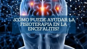 ¿Cómo puede ayudar la fisioterapia en la Encefalitis?