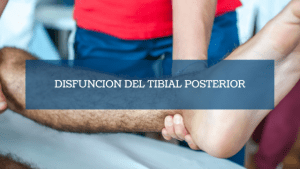 Destacada Disfuncion del tibial posterior