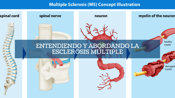 Imagen destacada Entendiendo y abordando la esclerosis múltiple