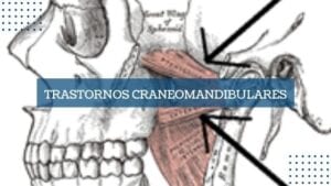 Trastornos craneomandibulares